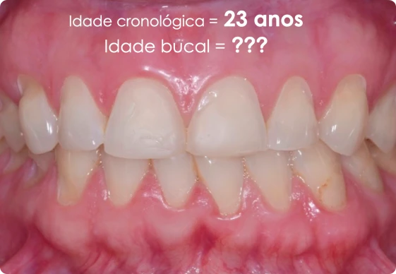 CA 01 - Idade