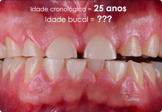 CA 02 - Idade