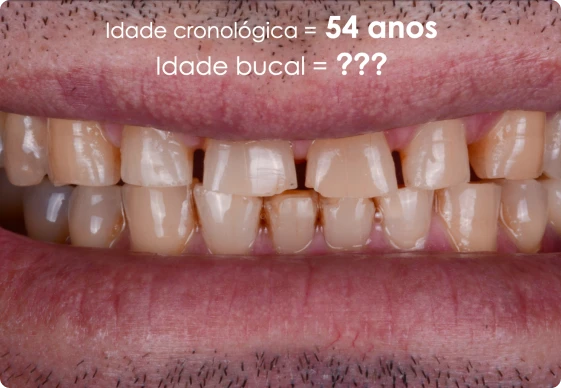 CA 03 - Idade