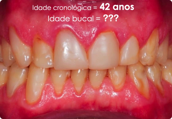 CA 04 - Idade