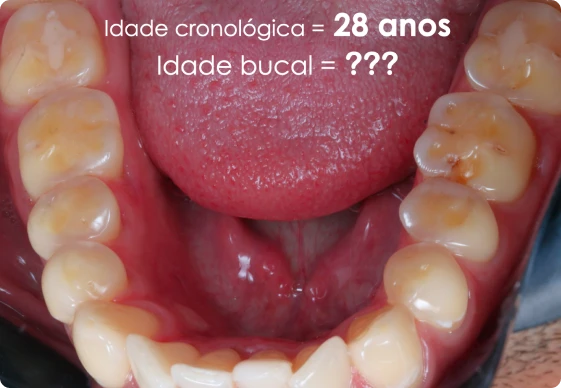 CA 05 - Idade
