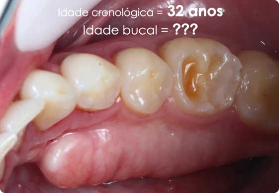 CA 06 - Idade